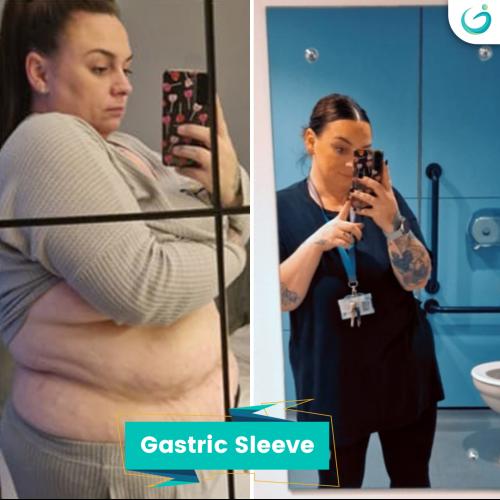 fotos antes y después de nuestros pacientes 4